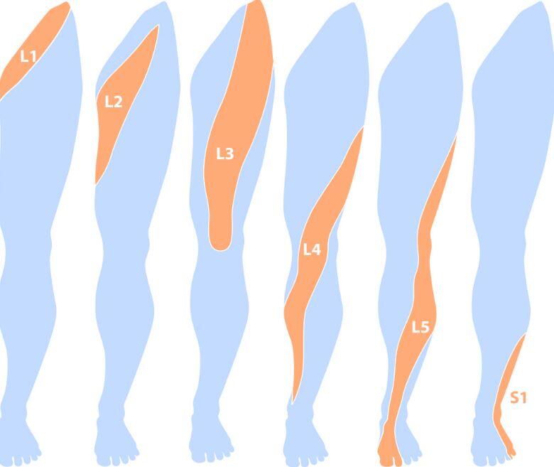 Dermatom Nedir? Vücudun Dermatom Haritası lumbal dermatomlar