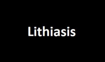 Lithiasis nedir