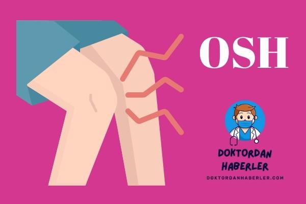 OSH tanısı belirtileri ve tedavisi