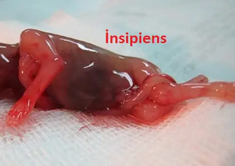 abortus insipiens nedir
