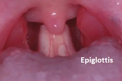 epiglottis
