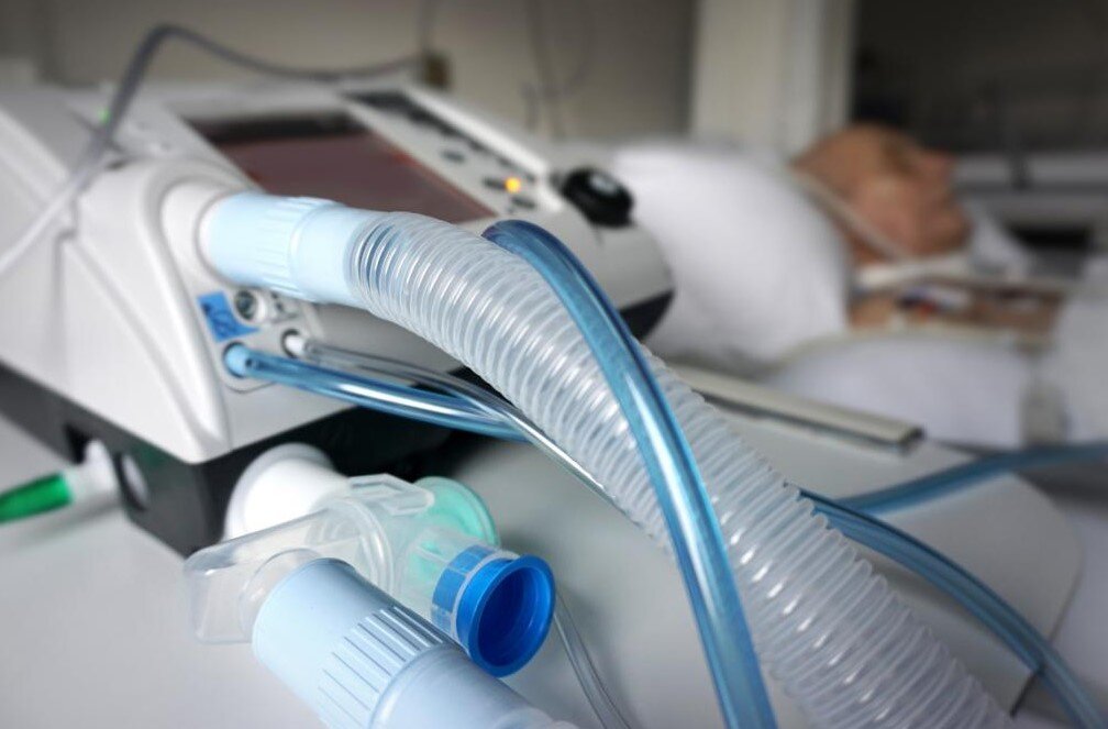 Akut Respiratuar Distres Sendrom tedavisi