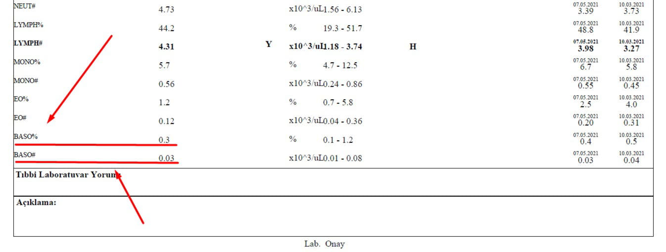 En Kapsamlı BASO Rehberi baso yüksekliği