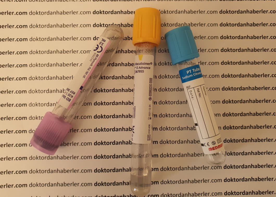 EOS Nedir? EOS Yüksekliği ve Düşüklüğü Kanda eozinofil yüksekliği