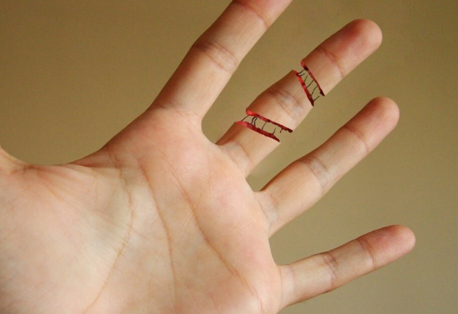 parmak kirigi ne zaman iyilesir