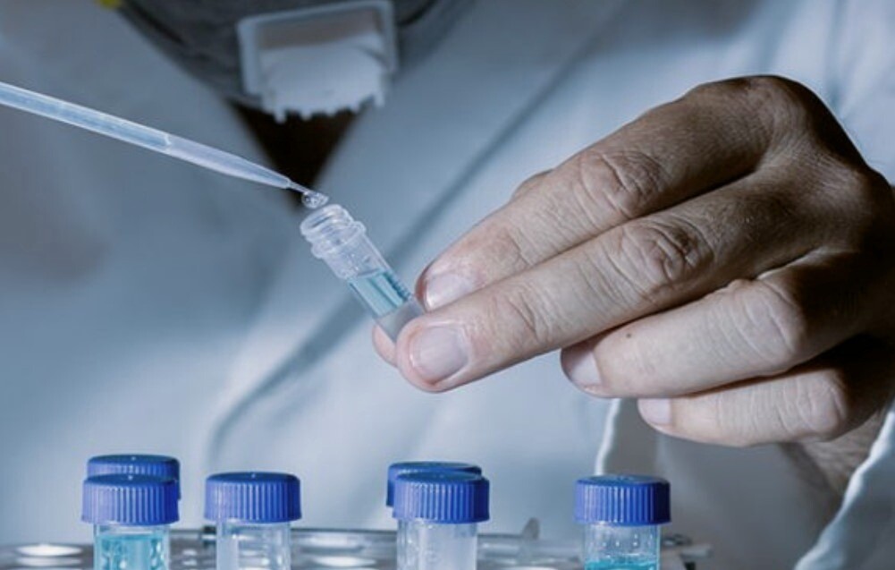 hormon testi yaptirmak icin hangi doktora gidilir