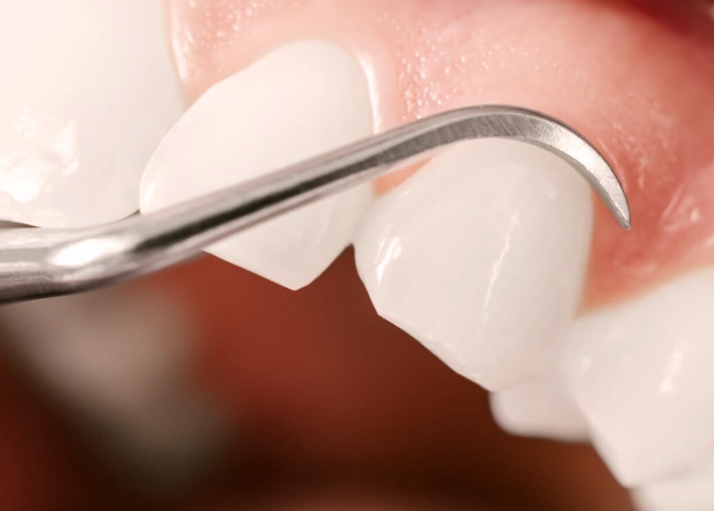 periodontoloji hangi hastaliklara bakar