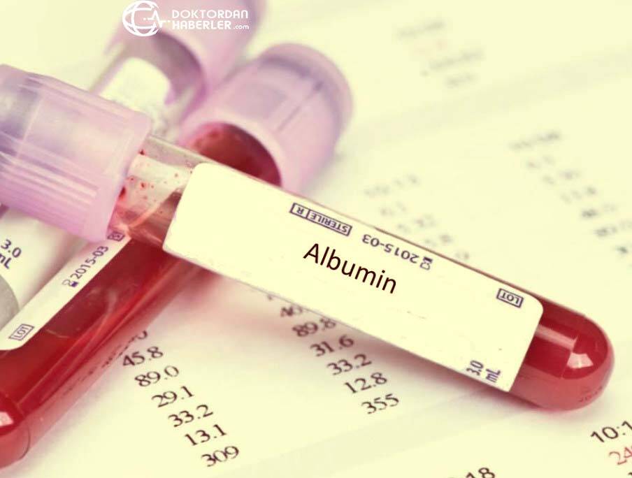 idrarda albumin testi