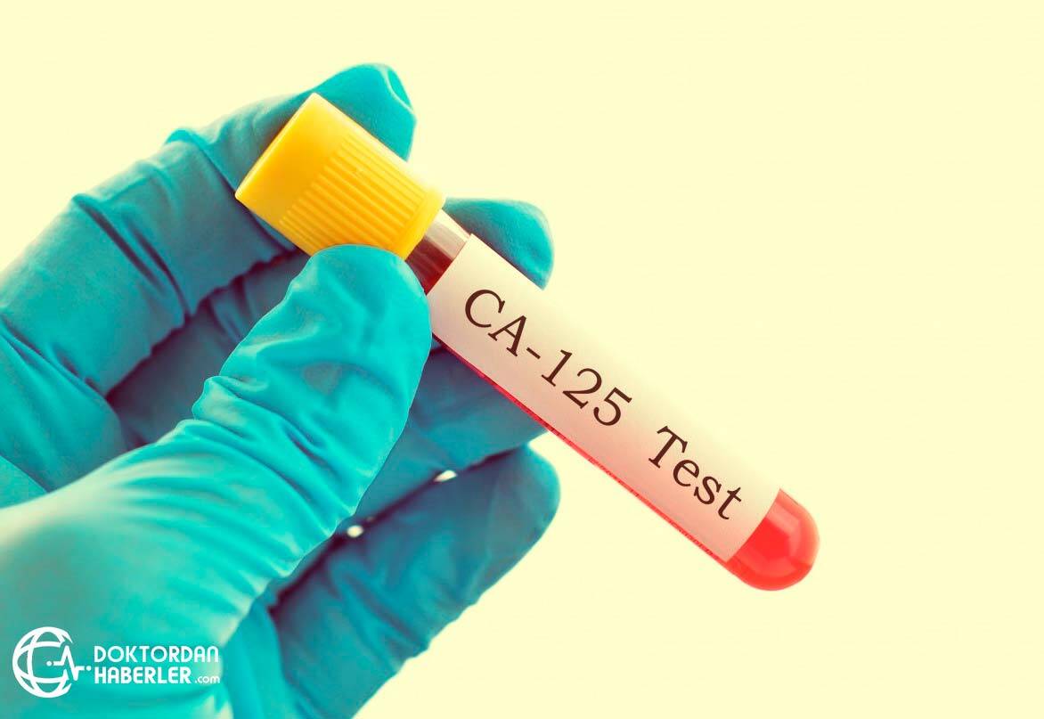 ca 125