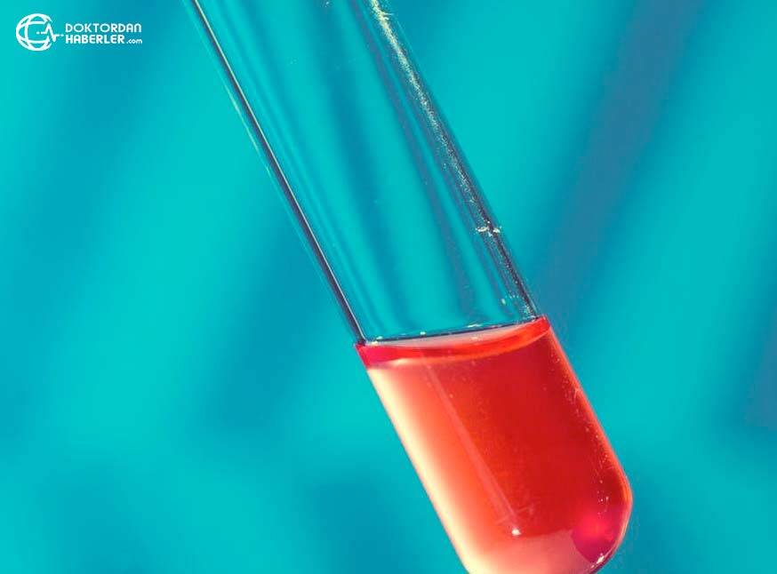 hdl kolesterol yuksek cikmasi