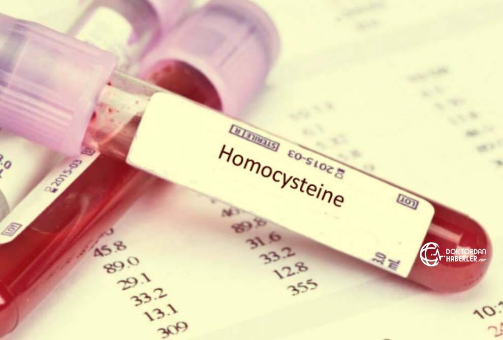 homosistein laboratuvar tahlili