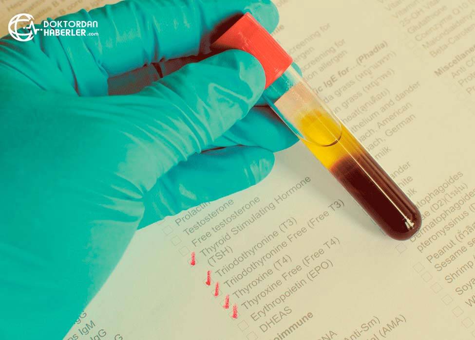 lh hormon testi sonucu