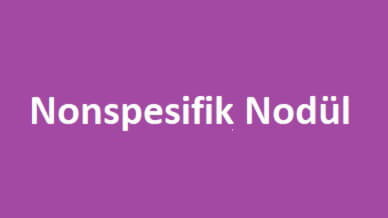nonspesifik nodül nedir