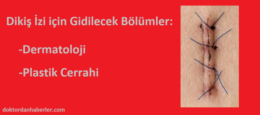 Dikiş İzi için Hangi Bölüme Gidilir? dikiş izine hangi bölüm bakar