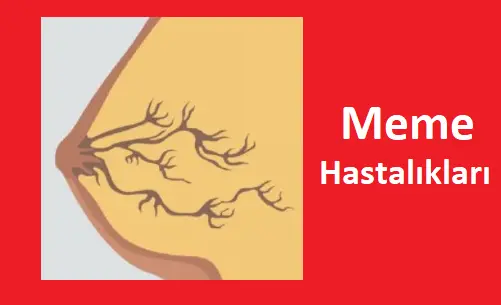 memede şişlik için hangi bölüme başvurmalıyım