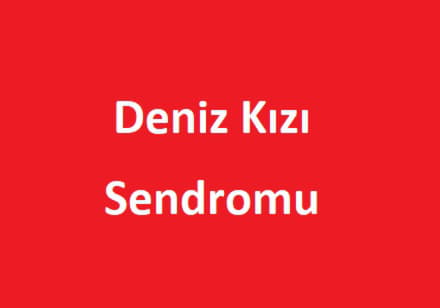 deniz-kizi-sendromu