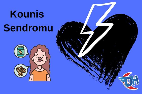 Kounis Sendromu