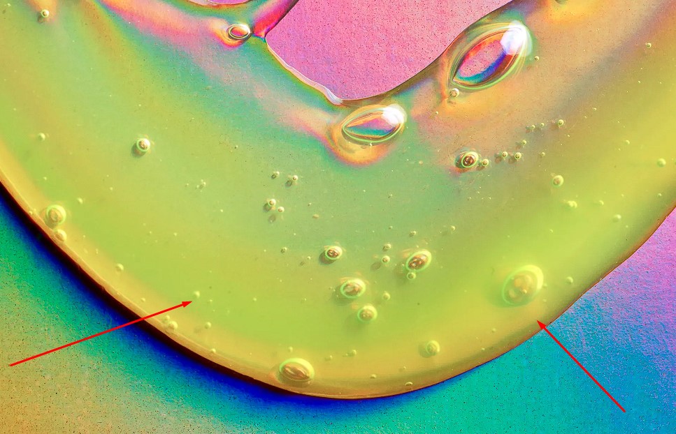 Burundan Sarı Su Gelmesi Hangi Bölüm Bakar? burundan sarı su gelmesi